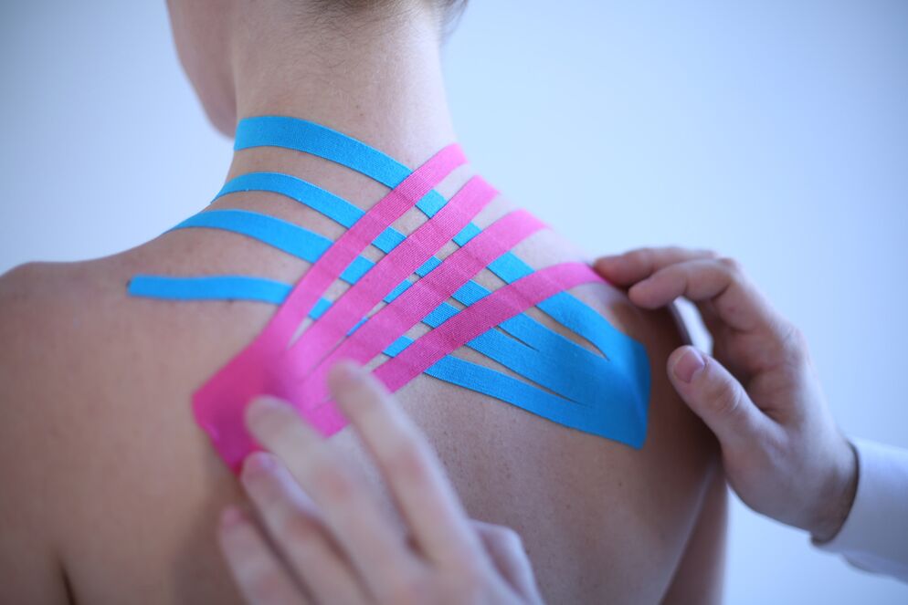 kinesiotaping para osteocondrose espinal