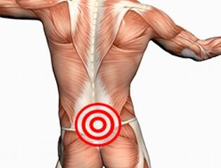 Osteocondrose da columna lumbar