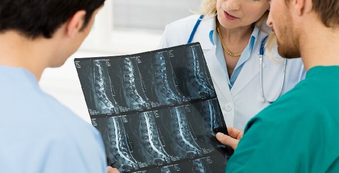 Radiografía da columna vertebral como forma de diagnosticar a osteocondrose